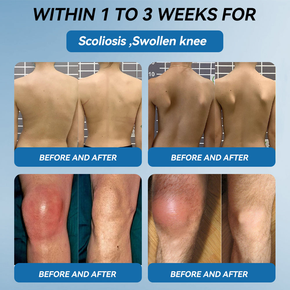 𝖯𝗂𝖼𝗱𝗼® BPC-157 Joint Healing Cream🦴Treats Arthritis, Neuropathy, Rheumatism, Sports Injuries & More🚁
