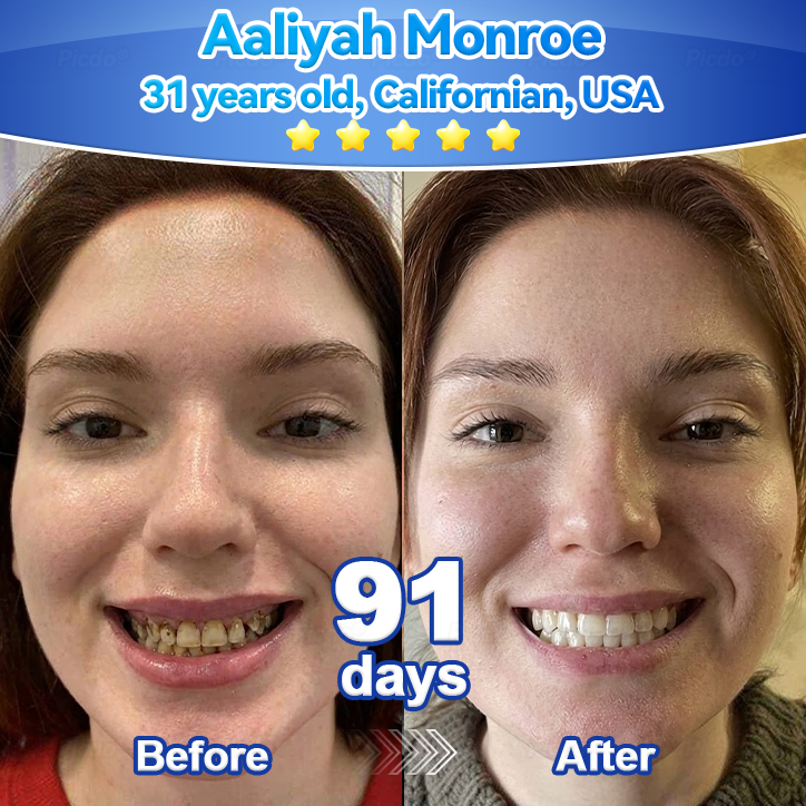 ✨🎇𝑃𝑖𝑐𝑑𝑜® 𝑆𝑡𝑒𝑚 𝐶𝑒𝑙𝑙 𝐺𝑖𝑛𝑔𝑖𝑣𝑎𝑙 𝑅𝑒𝑝𝑎𝑖𝑟 𝑀𝑜𝑢𝑠𝑠𝑒(🦷Promote Tooth Regrowth • Remove Tartar • Strengthen Gums • Deep Clean & Freshen Breath)🌵