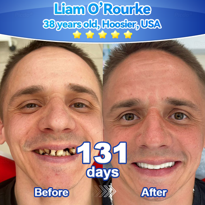 ✨🎇𝑃𝑖𝑐𝑑𝑜® 𝑆𝑡𝑒𝑚 𝐶𝑒𝑙𝑙 𝐺𝑖𝑛𝑔𝑖𝑣𝑎𝑙 𝑅𝑒𝑝𝑎𝑖𝑟 𝑀𝑜𝑢𝑠𝑠𝑒(🦷Promote Tooth Regrowth • Remove Tartar • Strengthen Gums • Deep Clean & Freshen Breath)🌵