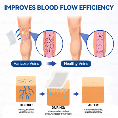 7-Day Visible Results✅𝑭𝑳𝑶𝑹𝑰𝑺𝑴𝑨® 𝐕𝐞𝐢𝐧 𝐂𝐨𝐧𝐭𝐨𝐮𝐫 𝑪𝒍𝒊𝒏𝒊𝒄𝒂𝒍-𝑮𝒓𝒂𝒅𝒆 𝑭𝒐𝒓𝒎𝒖𝒍𝒂 𝑴𝒊𝒄𝒓𝒐𝒏𝒆𝒆𝒅𝒍𝒆 𝑷𝒂𝒕𝒄𝒉(𝑫𝑰𝑶𝑺𝑴𝑰𝑵 & 𝑯𝑬𝑺𝑷𝑬𝑹𝑰𝑫𝑰𝑵)— 𝗔𝗱𝘃𝗮𝗻𝗰𝗲𝗱 𝗛𝗲𝗿𝗯𝗮𝗹 𝗕𝗹𝗲𝗻𝗱 𝗧𝗮𝗿𝗴𝗲𝘁𝘀 𝗦𝗽𝗶𝗱𝗲𝗿 𝗩𝗲𝗶𝗻𝘀 & 𝗥𝗲𝗹𝗶𝗲𝘃𝗲𝘀 𝗛𝗲𝗮𝘃𝘆, 𝗧𝗶𝗿𝗲𝗱 𝗟𝗲𝗴𝘀🚀
