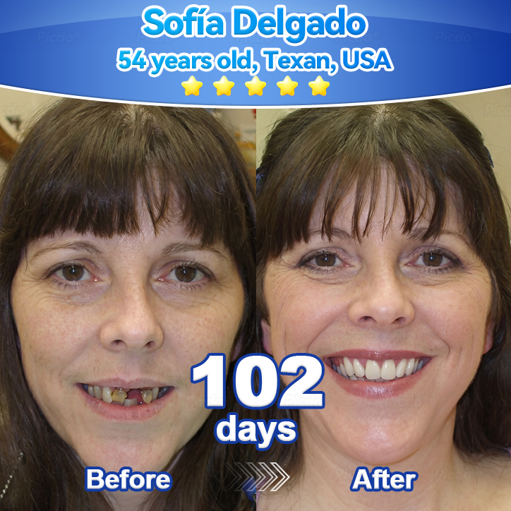 ✨🎇𝑃𝑖𝑐𝑑𝑜® 𝑆𝑡𝑒𝑚 𝐶𝑒𝑙𝑙 𝐺𝑖𝑛𝑔𝑖𝑣𝑎𝑙 𝑅𝑒𝑝𝑎𝑖𝑟 𝑀𝑜𝑢𝑠𝑠𝑒(🦷Promote Tooth Regrowth • Remove Tartar • Strengthen Gums • Deep Clean & Freshen Breath)🌵