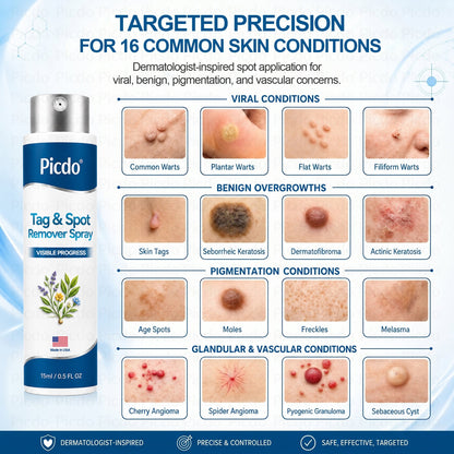 𝐏𝑖𝐜𝐝𝑜® 7-𝐷𝑎𝑦 𝑇𝑎𝑔 & 𝑆𝑝𝑜𝑡 𝑅𝑒𝑚𝑜𝑣𝑒𝑟 𝑆𝑝𝑟𝑎𝑦(Zero Pain, Zero 𝐒𝐜𝐚𝒓𝒔 Precision Spray)🚀