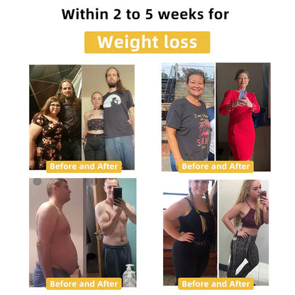 𝐂𝐯𝐫𝐞𝐨𝐳™ 𝐁𝐞𝐞 𝐕𝐞𝐧𝐨𝐦 𝐒𝐥𝐢𝐦𝐦𝐢𝐧𝐠 𝐏𝐚𝐭𝐜𝐡⭐(𝐟𝐨𝐫 𝐚𝐥𝐥 𝐥𝐲𝐦𝐩𝐡𝐚𝐭𝐢𝐜 𝐩𝐫𝐨𝐛𝐥𝐞𝐦𝐬 𝐚𝐧𝐝 𝐨𝐛𝐞𝐬𝐢𝐭𝐲)💎