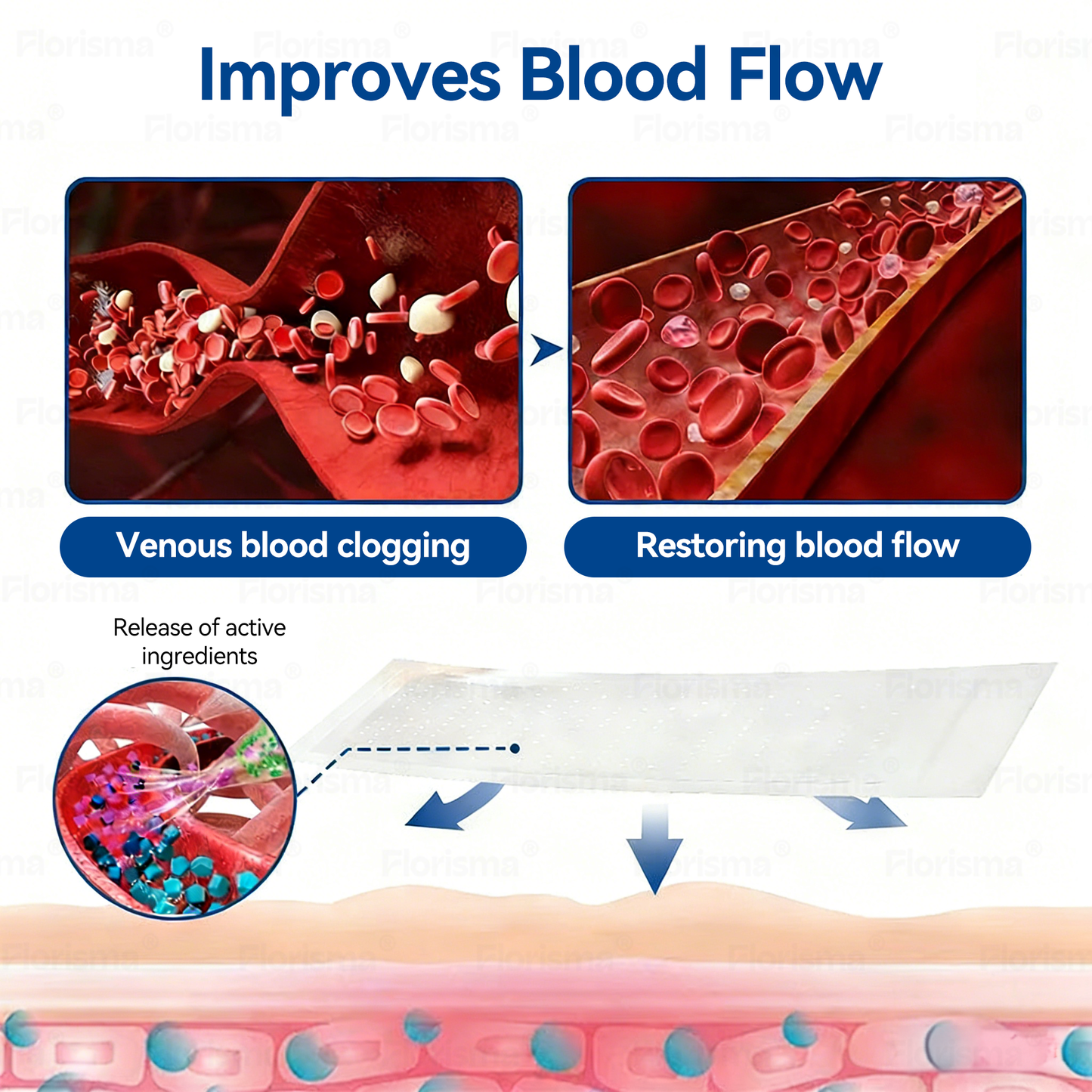 7-Day Visible Results✅𝑭𝑳𝑶𝑹𝑰𝑺𝑴𝑨® 𝐕𝐞𝐢𝐧 𝐂𝐨𝐧𝐭𝐨𝐮𝐫 𝑪𝒍𝒊𝒏𝒊𝒄𝒂𝒍-𝑮𝒓𝒂𝒅𝒆 𝑭𝒐𝒓𝒎𝒖𝒍𝒂 𝑴𝒊𝒄𝒓𝒐𝒏𝒆𝒆𝒅𝒍𝒆 𝑷𝒂𝒕𝒄𝒉(𝑫𝑰𝑶𝑺𝑴𝑰𝑵 & 𝑯𝑬𝑺𝑷𝑬𝑹𝑰𝑫𝑰𝑵)— 𝗔𝗱𝘃𝗮𝗻𝗰𝗲𝗱 𝗛𝗲𝗿𝗯𝗮𝗹 𝗕𝗹𝗲𝗻𝗱 𝗧𝗮𝗿𝗴𝗲𝘁𝘀 𝗦𝗽𝗶𝗱𝗲𝗿 𝗩𝗲𝗶𝗻𝘀 & 𝗥𝗲𝗹𝗶𝗲𝘃𝗲𝘀 𝗛𝗲𝗮𝘃𝘆, 𝗧𝗶𝗿𝗲𝗱 𝗟𝗲𝗴𝘀🚀
