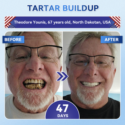 𝐆𝐥𝐢𝐦𝐦𝐞𝐫𝐥𝐲® 𝐓𝐢𝐝𝐞𝐠𝐥𝐮𝐬𝐢𝐛 𝐓𝐨𝐨𝐭𝐡 & 𝐆𝐮𝐦 𝐑𝐞𝐩𝐚𝐢𝐫 𝐌𝐢𝐜𝐫𝐨𝐧𝐞𝐞𝐝𝐥𝐞 𝐏𝐚𝐭𝐜𝐡  | 𝐀𝐝𝐯𝐚𝐧𝐜𝐞𝐝 𝐒𝐭𝐞𝐦-𝐂𝐞𝐥𝐥 𝐀𝐜𝐭𝐢𝐯𝐚𝐭𝐢𝐨𝐧 𝐓𝐞𝐞𝐭𝐡 𝐒𝐭𝐫𝐢𝐩𝐬(🦷𝐑𝐞𝐛𝐮𝐢𝐥𝐝 𝐄𝐧𝐚𝐦𝐞𝐥 & 𝐃𝐞𝐧𝐭𝐢𝐧 • 𝐒𝐭𝐫𝐞𝐧𝐠𝐭𝐡𝐞𝐧 𝐆𝐮𝐦𝐬 • 𝐄𝐫𝐚𝐝𝐢𝐜𝐚𝐭𝐞 𝐓𝐚𝐫𝐭𝐚𝐫 & 𝐎𝐝𝐨𝐫 • 𝐒𝐭𝐨𝐩 𝐓𝐨𝐨𝐭𝐡 𝐒𝐞𝐧𝐬𝐢𝐭𝐢𝐯𝐢𝐭𝐲) 🍒