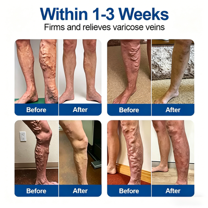 🇺🇸👨‍⚕️✅✅𝑭𝑳𝑶𝑹𝑰𝑺𝑴𝑨® VeinTarget Microneedle Patch⚡Instant Relief, Long-Term Results