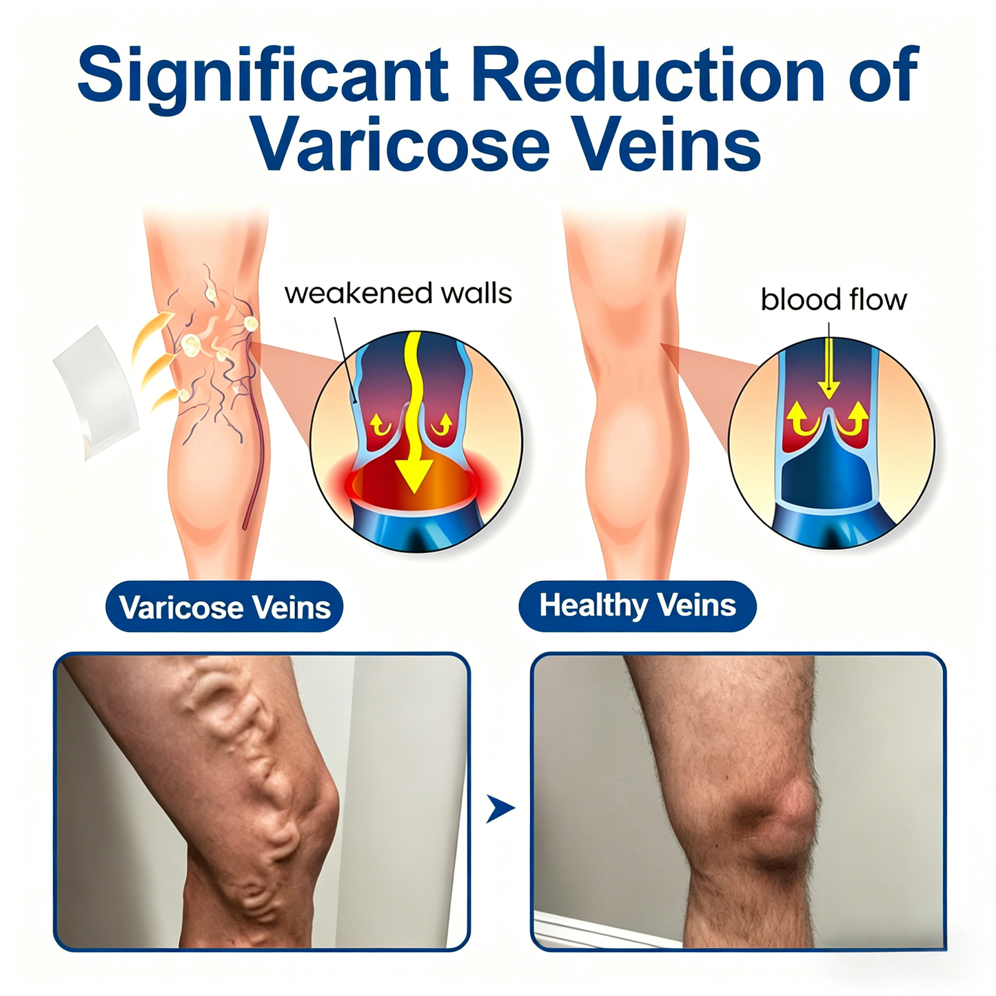 🇺🇸👨‍⚕️✅✅𝑭𝑳𝑶𝑹𝑰𝑺𝑴𝑨® VeinTarget Microneedle Patch⚡Instant Relief, Long-Term Results