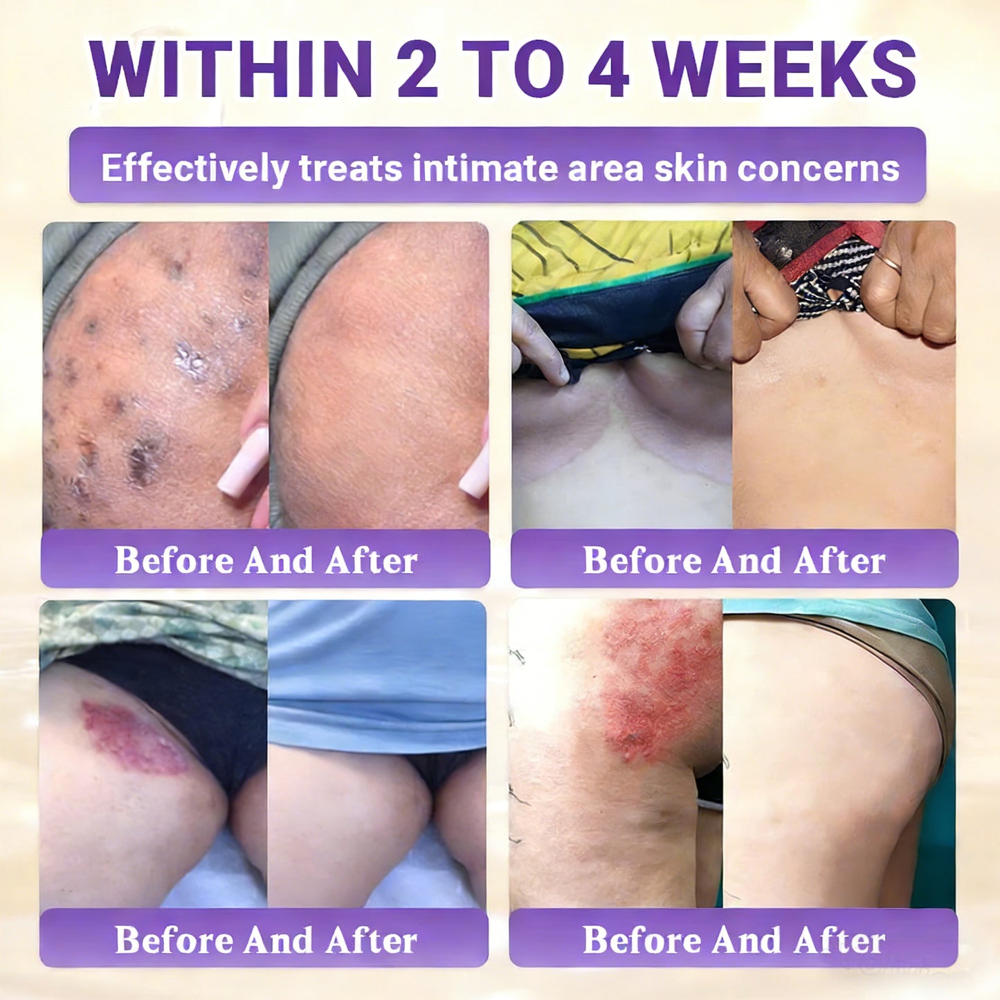 𝑶𝒇𝒇𝒊𝒄𝒊𝒂𝒍 𝑺𝒕𝒐𝒓𝒆 | 👩‍⚕️ 𝑾𝑹𝑬𝑬® 𝑩𝒊𝒐𝒕𝒊𝒏 & 𝑻𝒂𝒍𝒍𝒐𝒘 10-𝑰𝑵-1 𝑨𝒅𝒗𝒂𝒏𝒄𝒆𝒅 𝑹𝒆𝒔𝒕𝒐𝒓𝒂𝒕𝒊𝒐𝒏 𝑪𝒓𝒆𝒂𝒎 (𝐎𝐧𝐜𝐞 𝐃𝐚𝐢𝐥𝐲, 𝐯𝐢𝐬𝐢𝐛𝐥𝐞 𝐜𝐡𝐚𝐧𝐠𝐞𝐬 𝐢𝐧 𝟕 𝐝𝐚𝐲𝐬）✅ 𝑷𝒖𝒓𝒑𝒖𝒓𝒂, 𝑨𝒈𝒆 𝑺𝒑𝒐𝒕𝒔, 𝑾𝒓𝒊𝒏𝒌𝒍𝒆𝒔, 𝑨𝒏𝒅 𝑺𝒌𝒊𝒏 𝑻𝒂𝒈𝒔🔥