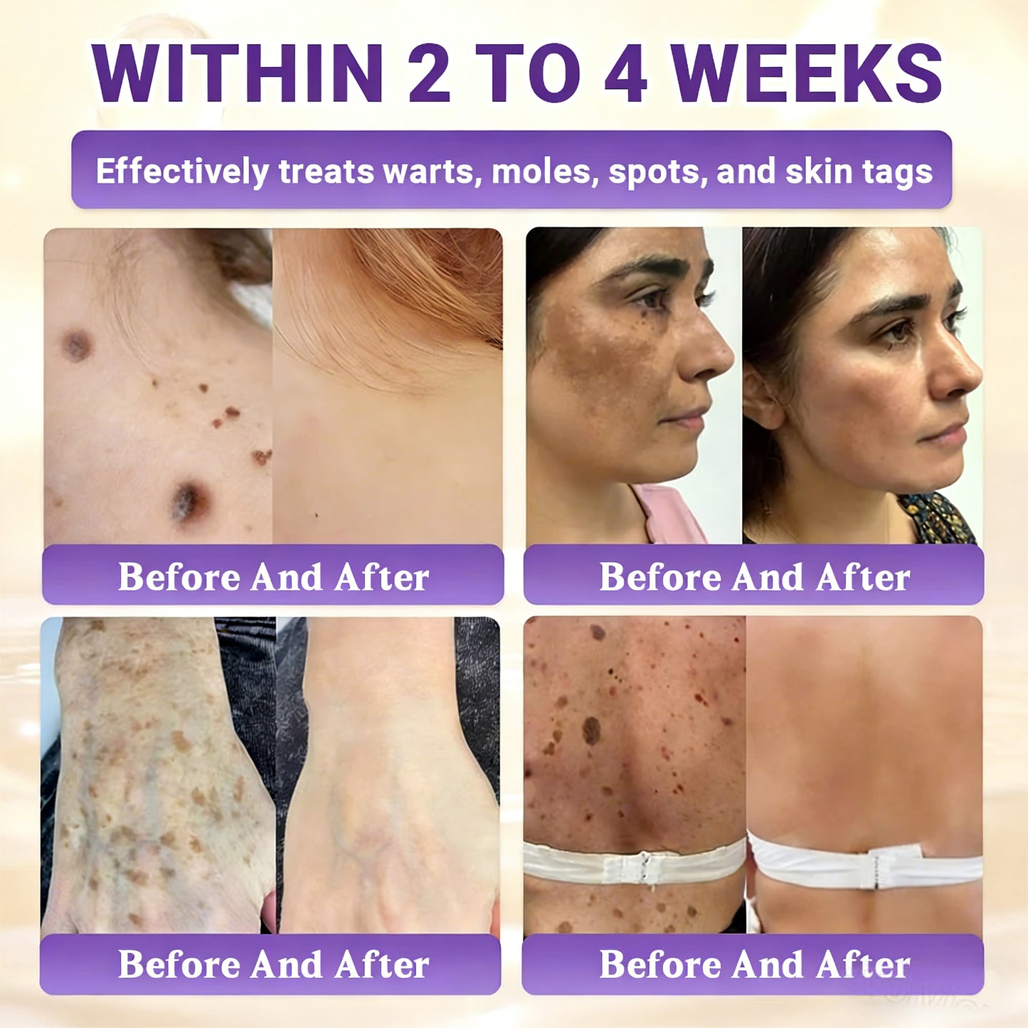 𝑶𝒇𝒇𝒊𝒄𝒊𝒂𝒍 𝑺𝒕𝒐𝒓𝒆 | 👩‍⚕️ 𝑾𝑹𝑬𝑬® 𝑩𝒊𝒐𝒕𝒊𝒏 & 𝑻𝒂𝒍𝒍𝒐𝒘 10-𝑰𝑵-1 𝑨𝒅𝒗𝒂𝒏𝒄𝒆𝒅 𝑹𝒆𝒔𝒕𝒐𝒓𝒂𝒕𝒊𝒐𝒏 𝑪𝒓𝒆𝒂𝒎 (𝐎𝐧𝐜𝐞 𝐃𝐚𝐢𝐥𝐲, 𝐯𝐢𝐬𝐢𝐛𝐥𝐞 𝐜𝐡𝐚𝐧𝐠𝐞𝐬 𝐢𝐧 𝟕 𝐝𝐚𝐲𝐬）✅ 𝑷𝒖𝒓𝒑𝒖𝒓𝒂, 𝑨𝒈𝒆 𝑺𝒑𝒐𝒕𝒔, 𝑾𝒓𝒊𝒏𝒌𝒍𝒆𝒔, 𝑨𝒏𝒅 𝑺𝒌𝒊𝒏 𝑻𝒂𝒈𝒔🔥