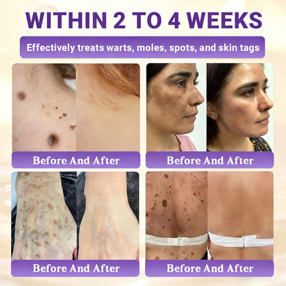 𝑶𝒇𝒇𝒊𝒄𝒊𝒂𝒍 𝑺𝒕𝒐𝒓𝒆 | 👩‍⚕️ 𝑾𝑹𝑬𝑬® 𝑩𝒊𝒐𝒕𝒊𝒏 & 𝑻𝒂𝒍𝒍𝒐𝒘 10-𝑰𝑵-1 𝑨𝒅𝒗𝒂𝒏𝒄𝒆𝒅 𝑹𝒆𝒔𝒕𝒐𝒓𝒂𝒕𝒊𝒐𝒏 𝑪𝒓𝒆𝒂𝒎 (𝐎𝐧𝐜𝐞 𝐃𝐚𝐢𝐥𝐲, 𝐯𝐢𝐬𝐢𝐛𝐥𝐞 𝐜𝐡𝐚𝐧𝐠𝐞𝐬 𝐢𝐧 𝟕 𝐝𝐚𝐲𝐬）✅ 𝑷𝒖𝒓𝒑𝒖𝒓𝒂, 𝑨𝒈𝒆 𝑺𝒑𝒐𝒕𝒔, 𝑾𝒓𝒊𝒏𝒌𝒍𝒆𝒔, 𝑨𝒏𝒅 𝑺𝒌𝒊𝒏 𝑻𝒂𝒈𝒔🔥
