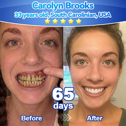 ✨🎇𝑃𝑖𝑐𝑑𝑜® 𝑆𝑡𝑒𝑚 𝐶𝑒𝑙𝑙 𝐺𝑖𝑛𝑔𝑖𝑣𝑎𝑙 𝑅𝑒𝑝𝑎𝑖𝑟 𝑀𝑜𝑢𝑠𝑠𝑒(🦷Promote Tooth Regrowth • Remove Tartar • Strengthen Gums • Deep Clean & Freshen Breath)🌵