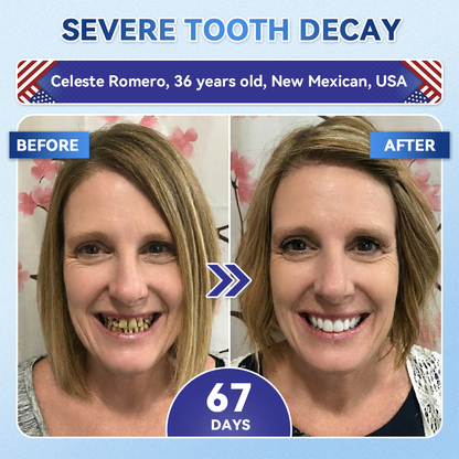 𝐆𝐥𝐢𝐦𝐦𝐞𝐫𝐥𝐲® 𝐓𝐢𝐝𝐞𝐠𝐥𝐮𝐬𝐢𝐛 𝐓𝐨𝐨𝐭𝐡 & 𝐆𝐮𝐦 𝐑𝐞𝐩𝐚𝐢𝐫 𝐌𝐢𝐜𝐫𝐨𝐧𝐞𝐞𝐝𝐥𝐞 𝐏𝐚𝐭𝐜𝐡  | 𝐀𝐝𝐯𝐚𝐧𝐜𝐞𝐝 𝐒𝐭𝐞𝐦-𝐂𝐞𝐥𝐥 𝐀𝐜𝐭𝐢𝐯𝐚𝐭𝐢𝐨𝐧 𝐓𝐞𝐞𝐭𝐡 𝐒𝐭𝐫𝐢𝐩𝐬(🦷𝐑𝐞𝐛𝐮𝐢𝐥𝐝 𝐄𝐧𝐚𝐦𝐞𝐥 & 𝐃𝐞𝐧𝐭𝐢𝐧 • 𝐒𝐭𝐫𝐞𝐧𝐠𝐭𝐡𝐞𝐧 𝐆𝐮𝐦𝐬 • 𝐄𝐫𝐚𝐝𝐢𝐜𝐚𝐭𝐞 𝐓𝐚𝐫𝐭𝐚𝐫 & 𝐎𝐝𝐨𝐫 • 𝐒𝐭𝐨𝐩 𝐓𝐨𝐨𝐭𝐡 𝐒𝐞𝐧𝐬𝐢𝐭𝐢𝐯𝐢𝐭𝐲) 🍒