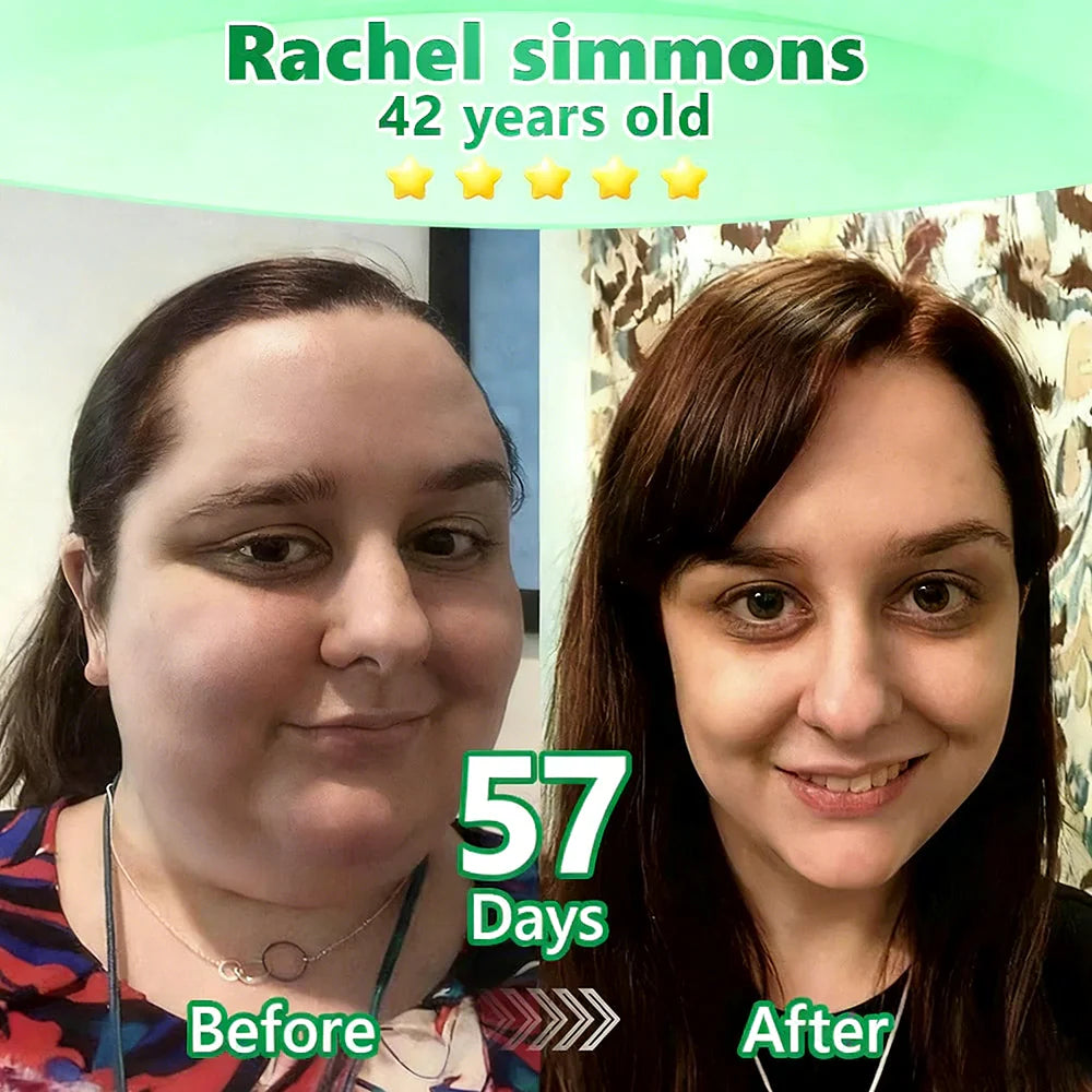 𝑶𝒇𝒇𝒊𝒄𝒊𝒂𝒍 𝑺𝒕𝒐𝒓𝒆👩‍⚕️𝑳𝒖𝒙𝒂𝒓𝒊𝒔𝒆® 𝑴𝒐𝒓𝒊𝒏𝒈𝒂 x 𝑩𝒆𝒓𝒃𝒆𝒓𝒊𝒏𝒆 10-𝑰𝑵-1 𝑨𝒅𝒗𝒂𝒏𝒄𝒆𝒅 𝑵𝒂𝒏𝒐 𝑴𝒊𝒄𝒓𝒐𝒏𝒆𝒆𝒅𝒍𝒆 𝑷𝒂𝒕𝒄𝒉 (𝐎𝐧𝐜𝐞 𝐃𝐚𝐢𝐥𝐲, 𝐯𝐢𝐬𝐢𝐛𝐥𝐞 𝐜𝐡𝐚𝐧𝐠𝐞𝐬 𝐢𝐧 𝟕 𝐝𝐚𝐲𝐬) 𝐎𝐛𝐞𝐬𝐢𝐭𝐲, 𝐃𝐢𝐚𝐛𝐞𝐭𝐞𝐬, 𝐒𝐥𝐞𝐞𝐩 𝐀𝐩𝐧𝐞𝐚, 𝐀𝐧𝐝 𝐉𝐨𝐢𝐧𝐭 𝐈𝐬𝐬𝐮𝐞𝐬 🔥