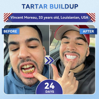 𝐆𝐥𝐢𝐦𝐦𝐞𝐫𝐥𝐲® 𝐓𝐢𝐝𝐞𝐠𝐥𝐮𝐬𝐢𝐛 𝐓𝐨𝐨𝐭𝐡 & 𝐆𝐮𝐦 𝐑𝐞𝐩𝐚𝐢𝐫 𝐌𝐢𝐜𝐫𝐨𝐧𝐞𝐞𝐝𝐥𝐞 𝐏𝐚𝐭𝐜𝐡  | 𝐀𝐝𝐯𝐚𝐧𝐜𝐞𝐝 𝐒𝐭𝐞𝐦-𝐂𝐞𝐥𝐥 𝐀𝐜𝐭𝐢𝐯𝐚𝐭𝐢𝐨𝐧 𝐓𝐞𝐞𝐭𝐡 𝐒𝐭𝐫𝐢𝐩𝐬(🦷𝐑𝐞𝐛𝐮𝐢𝐥𝐝 𝐄𝐧𝐚𝐦𝐞𝐥 & 𝐃𝐞𝐧𝐭𝐢𝐧 • 𝐒𝐭𝐫𝐞𝐧𝐠𝐭𝐡𝐞𝐧 𝐆𝐮𝐦𝐬 • 𝐄𝐫𝐚𝐝𝐢𝐜𝐚𝐭𝐞 𝐓𝐚𝐫𝐭𝐚𝐫 & 𝐎𝐝𝐨𝐫 • 𝐒𝐭𝐨𝐩 𝐓𝐨𝐨𝐭𝐡 𝐒𝐞𝐧𝐬𝐢𝐭𝐢𝐯𝐢𝐭𝐲) 🍁