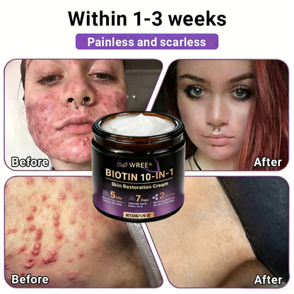 𝑶𝒇𝒇𝒊𝒄𝒊𝒂𝒍 𝑺𝒕𝒐𝒓𝒆 | 👩‍⚕️ 𝑾𝑹𝑬𝑬® 𝑩𝒊𝒐𝒕𝒊𝒏 & 𝑻𝒂𝒍𝒍𝒐𝒘 10-𝑰𝑵-1 𝑨𝒅𝒗𝒂𝒏𝒄𝒆𝒅 𝑹𝒆𝒔𝒕𝒐𝒓𝒂𝒕𝒊𝒐𝒏 𝑪𝒓𝒆𝒂𝒎 (𝐎𝐧𝐜𝐞 𝐃𝐚𝐢𝐥𝐲, 𝐯𝐢𝐬𝐢𝐛𝐥𝐞 𝐜𝐡𝐚𝐧𝐠𝐞𝐬 𝐢𝐧 𝟕 𝐝𝐚𝐲𝐬）✅ 𝑷𝒖𝒓𝒑𝒖𝒓𝒂, 𝑨𝒈𝒆 𝑺𝒑𝒐𝒕𝒔, 𝑾𝒓𝒊𝒏𝒌𝒍𝒆𝒔, 𝑨𝒏𝒅 𝑺𝒌𝒊𝒏 𝑻𝒂𝒈𝒔🔥