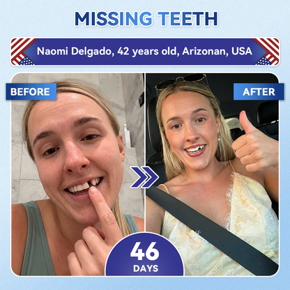 𝐆𝐥𝐢𝐦𝐦𝐞𝐫𝐥𝐲® 𝐓𝐢𝐝𝐞𝐠𝐥𝐮𝐬𝐢𝐛 𝐓𝐨𝐨𝐭𝐡 & 𝐆𝐮𝐦 𝐑𝐞𝐩𝐚𝐢𝐫 𝐌𝐢𝐜𝐫𝐨𝐧𝐞𝐞𝐝𝐥𝐞 𝐏𝐚𝐭𝐜𝐡  | 𝐀𝐝𝐯𝐚𝐧𝐜𝐞𝐝 𝐒𝐭𝐞𝐦-𝐂𝐞𝐥𝐥 𝐀𝐜𝐭𝐢𝐯𝐚𝐭𝐢𝐨𝐧 𝐓𝐞𝐞𝐭𝐡 𝐒𝐭𝐫𝐢𝐩𝐬(🦷𝐑𝐞𝐛𝐮𝐢𝐥𝐝 𝐄𝐧𝐚𝐦𝐞𝐥 & 𝐃𝐞𝐧𝐭𝐢𝐧 • 𝐒𝐭𝐫𝐞𝐧𝐠𝐭𝐡𝐞𝐧 𝐆𝐮𝐦𝐬 • 𝐄𝐫𝐚𝐝𝐢𝐜𝐚𝐭𝐞 𝐓𝐚𝐫𝐭𝐚𝐫 & 𝐎𝐝𝐨𝐫 • 𝐒𝐭𝐨𝐩 𝐓𝐨𝐨𝐭𝐡 𝐒𝐞𝐧𝐬𝐢𝐭𝐢𝐯𝐢𝐭𝐲) 🍁