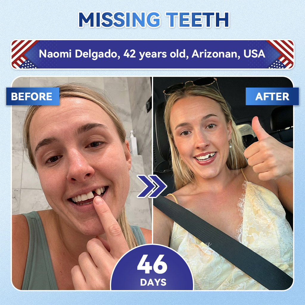 𝐆𝐥𝐢𝐦𝐦𝐞𝐫𝐥𝐲® 𝐓𝐢𝐝𝐞𝐠𝐥𝐮𝐬𝐢𝐛 𝐓𝐨𝐨𝐭𝐡 & 𝐆𝐮𝐦 𝐑𝐞𝐩𝐚𝐢𝐫 𝐌𝐢𝐜𝐫𝐨𝐧𝐞𝐞𝐝𝐥𝐞 𝐏𝐚𝐭𝐜𝐡  | 𝐀𝐝𝐯𝐚𝐧𝐜𝐞𝐝 𝐒𝐭𝐞𝐦-𝐂𝐞𝐥𝐥 𝐀𝐜𝐭𝐢𝐯𝐚𝐭𝐢𝐨𝐧 𝐓𝐞𝐞𝐭𝐡 𝐒𝐭𝐫𝐢𝐩𝐬(🦷𝐑𝐞𝐛𝐮𝐢𝐥𝐝 𝐄𝐧𝐚𝐦𝐞𝐥 & 𝐃𝐞𝐧𝐭𝐢𝐧 • 𝐒𝐭𝐫𝐞𝐧𝐠𝐭𝐡𝐞𝐧 𝐆𝐮𝐦𝐬 • 𝐄𝐫𝐚𝐝𝐢𝐜𝐚𝐭𝐞 𝐓𝐚𝐫𝐭𝐚𝐫 & 𝐎𝐝𝐨𝐫 • 𝐒𝐭𝐨𝐩 𝐓𝐨𝐨𝐭𝐡 𝐒𝐞𝐧𝐬𝐢𝐭𝐢𝐯𝐢𝐭𝐲) 🍒