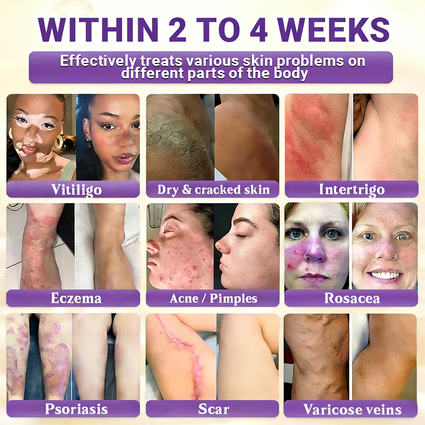 𝑶𝒇𝒇𝒊𝒄𝒊𝒂𝒍 𝑺𝒕𝒐𝒓𝒆 | 👩‍⚕️ 𝑾𝑹𝑬𝑬® 𝑩𝒊𝒐𝒕𝒊𝒏 & 𝑻𝒂𝒍𝒍𝒐𝒘 10-𝑰𝑵-1 𝑨𝒅𝒗𝒂𝒏𝒄𝒆𝒅 𝑹𝒆𝒔𝒕𝒐𝒓𝒂𝒕𝒊𝒐𝒏 𝑪𝒓𝒆𝒂𝒎 (𝐎𝐧𝐜𝐞 𝐃𝐚𝐢𝐥𝐲, 𝐯𝐢𝐬𝐢𝐛𝐥𝐞 𝐜𝐡𝐚𝐧𝐠𝐞𝐬 𝐢𝐧 𝟕 𝐝𝐚𝐲𝐬）✅ 𝑷𝒖𝒓𝒑𝒖𝒓𝒂, 𝑨𝒈𝒆 𝑺𝒑𝒐𝒕𝒔, 𝑾𝒓𝒊𝒏𝒌𝒍𝒆𝒔, 𝑨𝒏𝒅 𝑺𝒌𝒊𝒏 𝑻𝒂𝒈𝒔🔥