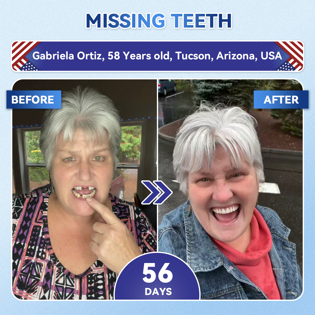 🦷𝐆𝐥𝐢𝐦𝐦𝐞𝐫𝐥𝐲® 𝐓𝐢𝐝𝐞𝐠𝐥𝐮𝐬𝐢𝐛 𝐓𝐨𝐨𝐭𝐡 & 𝐆𝐮𝐦 𝐑𝐞𝐩𝐚𝐢𝐫 𝐌𝐢𝐜𝐫𝐨𝐧𝐞𝐞𝐝𝐥𝐞 𝐏𝐚𝐭𝐜𝐡  | 𝐀𝐝𝐯𝐚𝐧𝐜𝐞𝐝 𝐒𝐭𝐞𝐦-𝐂𝐞𝐥𝐥 𝐀𝐜𝐭𝐢𝐯𝐚𝐭𝐢𝐨𝐧 𝐓𝐞𝐞𝐭𝐡 𝐒𝐭𝐫𝐢𝐩𝐬(🦷𝐑𝐞𝐛𝐮𝐢𝐥𝐝 𝐄𝐧𝐚𝐦𝐞𝐥 & 𝐃𝐞𝐧𝐭𝐢𝐧 • 𝐒𝐭𝐫𝐞𝐧𝐠𝐭𝐡𝐞𝐧 𝐆𝐮𝐦𝐬 • 𝐄𝐫𝐚𝐝𝐢𝐜𝐚𝐭𝐞 𝐓𝐚𝐫𝐭𝐚𝐫 & 𝐎𝐝𝐨𝐫 • 𝐒𝐭𝐨𝐩 𝐓𝐨𝐨𝐭𝐡 𝐒𝐞𝐧𝐬𝐢𝐭𝐢𝐯𝐢𝐭𝐲) 3.0