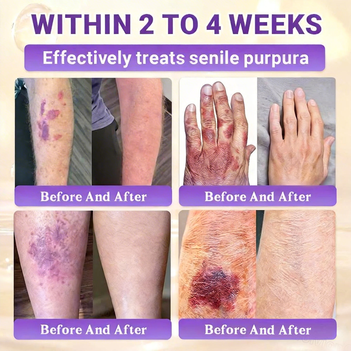 𝑶𝒇𝒇𝒊𝒄𝒊𝒂𝒍 𝑺𝒕𝒐𝒓𝒆 | 👩‍⚕️ 𝑾𝑹𝑬𝑬® 𝑩𝒊𝒐𝒕𝒊𝒏 & 𝑻𝒂𝒍𝒍𝒐𝒘 10-𝑰𝑵-1 𝑨𝒅𝒗𝒂𝒏𝒄𝒆𝒅 𝑹𝒆𝒔𝒕𝒐𝒓𝒂𝒕𝒊𝒐𝒏 𝑪𝒓𝒆𝒂𝒎 (𝐎𝐧𝐜𝐞 𝐃𝐚𝐢𝐥𝐲, 𝐯𝐢𝐬𝐢𝐛𝐥𝐞 𝐜𝐡𝐚𝐧𝐠𝐞𝐬 𝐢𝐧 𝟕 𝐝𝐚𝐲𝐬）✅ 𝑷𝒖𝒓𝒑𝒖𝒓𝒂, 𝑨𝒈𝒆 𝑺𝒑𝒐𝒕𝒔, 𝑾𝒓𝒊𝒏𝒌𝒍𝒆𝒔, 𝑨𝒏𝒅 𝑺𝒌𝒊𝒏 𝑻𝒂𝒈𝒔🔥