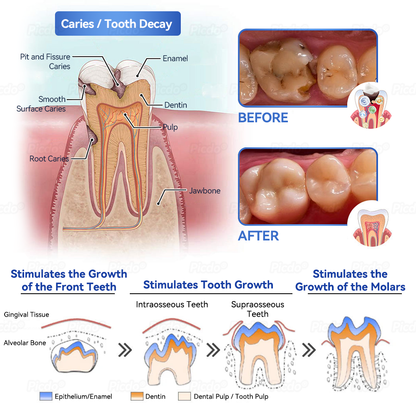 ✨🎇𝑃𝑖𝑐𝑑𝑜® 𝑆𝑡𝑒𝑚 𝐶𝑒𝑙𝑙 𝐺𝑖𝑛𝑔𝑖𝑣𝑎𝑙 𝑅𝑒𝑝𝑎𝑖𝑟 𝑀𝑜𝑢𝑠𝑠𝑒(🦷Promote Tooth Regrowth • Remove Tartar • Strengthen Gums • Deep Clean & Freshen Breath)🌵