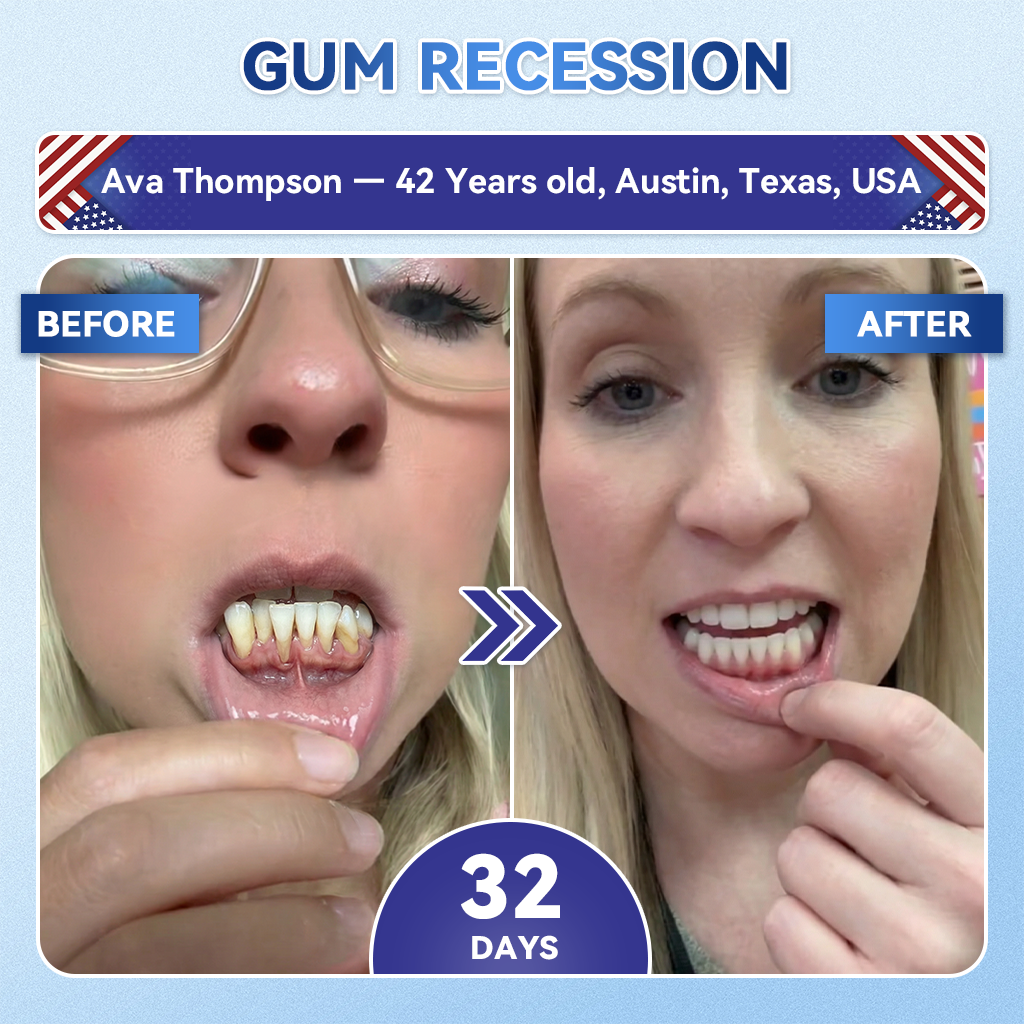 🦷𝐆𝐥𝐢𝐦𝐦𝐞𝐫𝐥𝐲® 𝐓𝐢𝐝𝐞𝐠𝐥𝐮𝐬𝐢𝐛 𝐓𝐨𝐨𝐭𝐡 & 𝐆𝐮𝐦 𝐑𝐞𝐩𝐚𝐢𝐫 𝐌𝐢𝐜𝐫𝐨𝐧𝐞𝐞𝐝𝐥𝐞 𝐏𝐚𝐭𝐜𝐡  | 𝐀𝐝𝐯𝐚𝐧𝐜𝐞𝐝 𝐒𝐭𝐞𝐦-𝐂𝐞𝐥𝐥 𝐀𝐜𝐭𝐢𝐯𝐚𝐭𝐢𝐨𝐧 𝐓𝐞𝐞𝐭𝐡 𝐒𝐭𝐫𝐢𝐩𝐬(🦷𝐑𝐞𝐛𝐮𝐢𝐥𝐝 𝐄𝐧𝐚𝐦𝐞𝐥 & 𝐃𝐞𝐧𝐭𝐢𝐧 • 𝐒𝐭𝐫𝐞𝐧𝐠𝐭𝐡𝐞𝐧 𝐆𝐮𝐦𝐬 • 𝐄𝐫𝐚𝐝𝐢𝐜𝐚𝐭𝐞 𝐓𝐚𝐫𝐭𝐚𝐫 & 𝐎𝐝𝐨𝐫 • 𝐒𝐭𝐨𝐩 𝐓𝐨𝐨𝐭𝐡 𝐒𝐞𝐧𝐬𝐢𝐭𝐢𝐯𝐢𝐭𝐲) 3.0